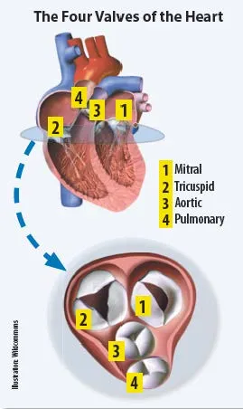 fourvalves
