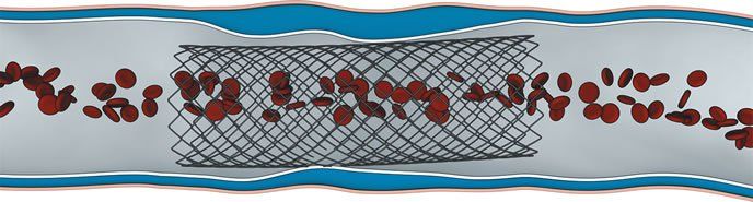 p19lrm6fup1f3j1oduct11c7k177r6