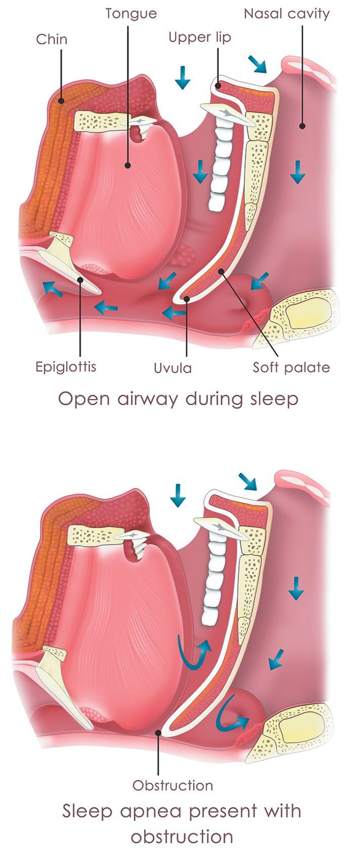 p19mvonmrs1r0u5jh5d2qatn216