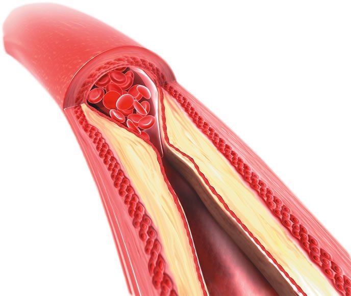 p19t8c3me51srr100819tc413pug6