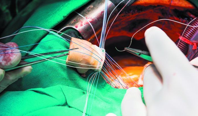 p1a90e1dbgb0q4nv1rtjf4h1rhv6