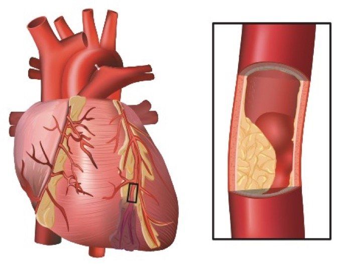 p1br5oi0601mspocmi6u1md21ge16