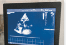 Closer Monitoring After Aortic Valve Replacement Advised